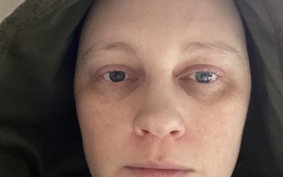 Når velfærdssystemerne (re)traumatiserer