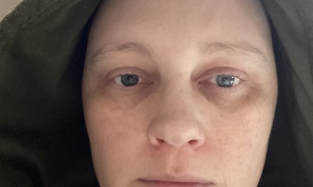 Når velfærdssystemerne (re)traumatiserer